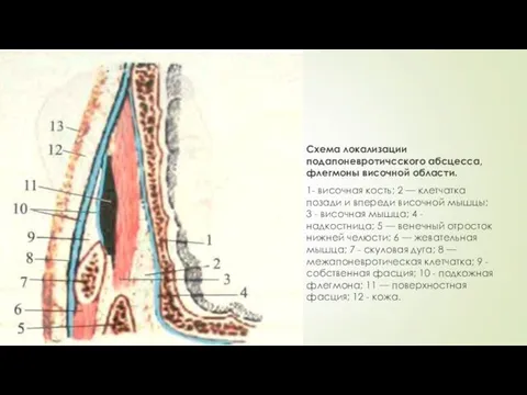 Схема локализации подапоневротичсского абсцесса, флегмоны височной области. 1- височная кость; 2