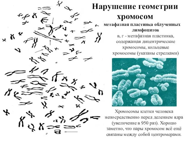 Нарушение геометрии хромосом метафазная пластинка облученных лимфоцитов в, г - метафазная