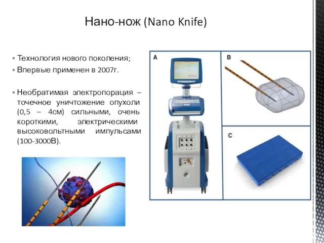 Нано-нож (Nano Knife) Технология нового поколения; Впервые применен в 2007г. Необратимая