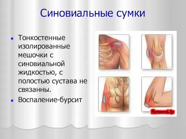 Синовиальные сумки Тонкостенные изолированные мешочки с синовиальной жидкостью, с полостью сустава не связанны. Воспаление-бурсит