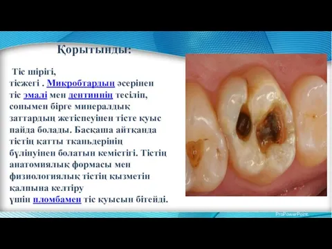 Гаухар набирает сообщение.. Қорытынды: Тіс шірігі, тісжегі . Микробтардың әсерінен тіс