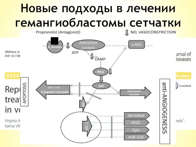 Новые подходы в лечении гемангиобластомы сетчатки