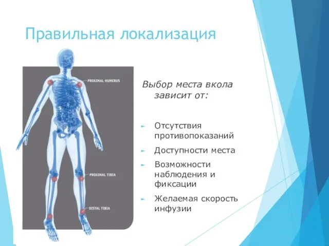 Правильная локализация Выбор места вкола зависит от: Отсутствия противопоказаний Доступности места