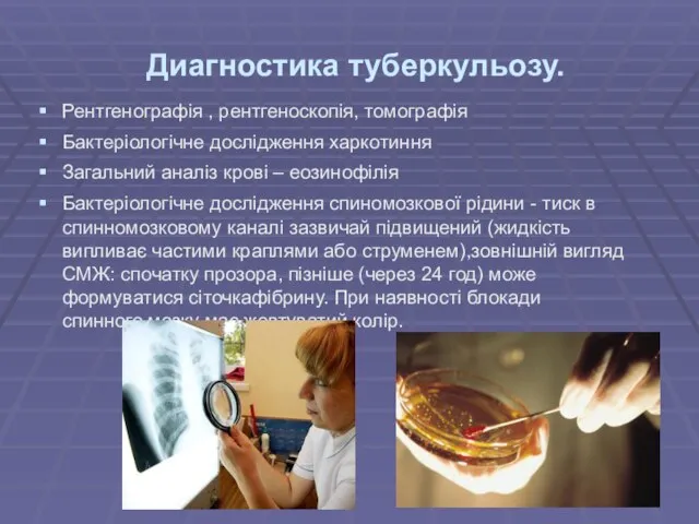 Диагностика туберкульозу. Рентгенографія , рентгеноскопія, томографія Бактеріологічне дослідження харкотиння Загальний аналіз