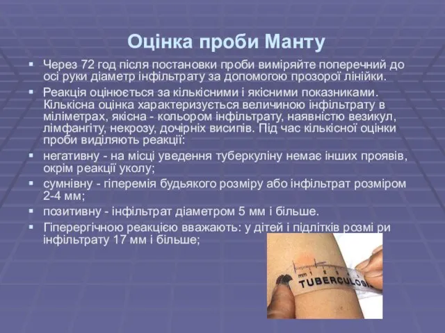 Оцінка проби Манту Через 72 год після постановки проби виміряйте поперечний