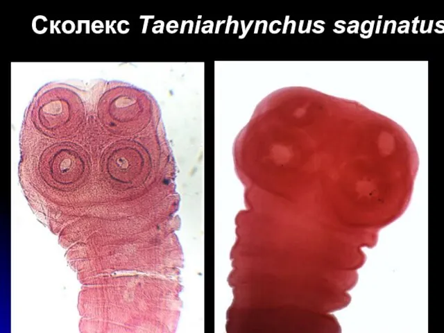 Сколекс Taeniarhynchus saginatus