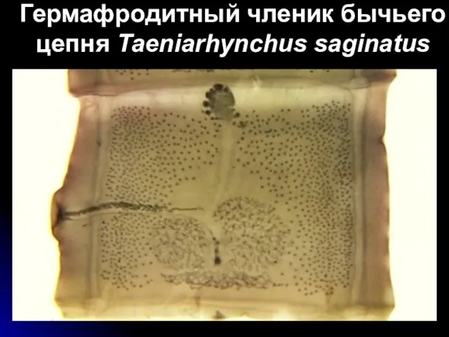 Гермафродитный членик бычьего цепня Taeniarhynchus saginatus