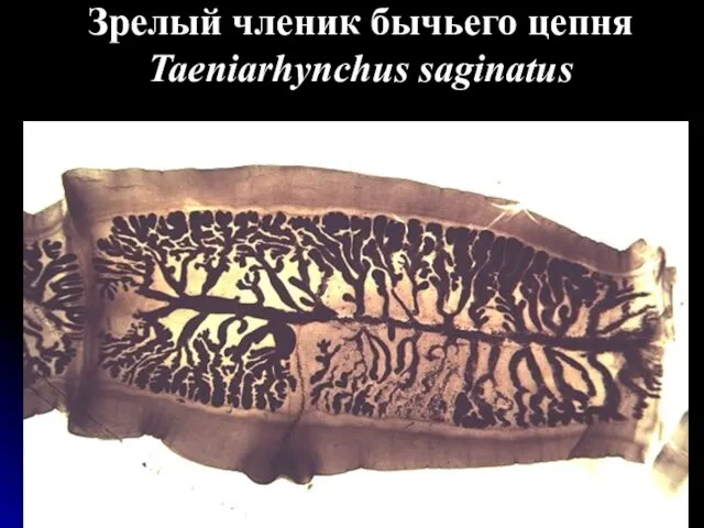 Зрелый членик бычьего цепня Taeniarhynchus saginatus