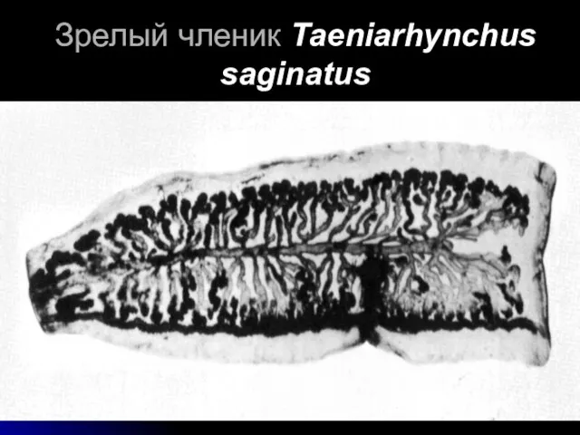 Зрелый членик Taeniarhynchus saginatus