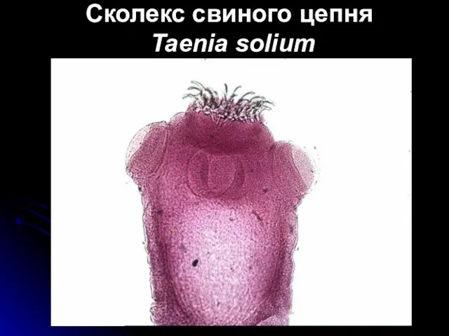 Сколекс свиного цепня Taenia solium