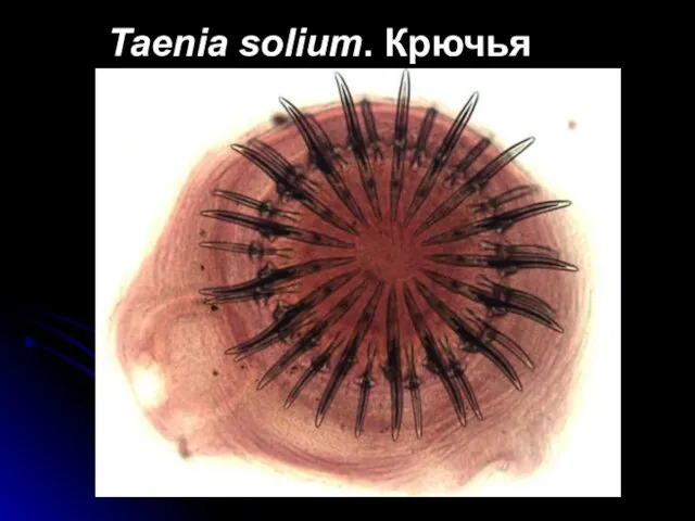 Taenia solium. Крючья