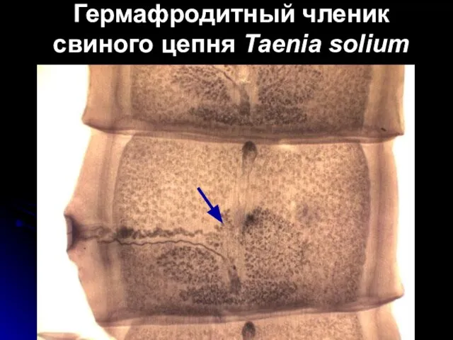 Гермафродитный членик свиного цепня Taenia solium