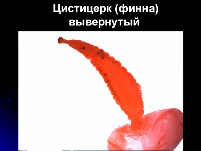 Цистицерк (финна) вывернутый