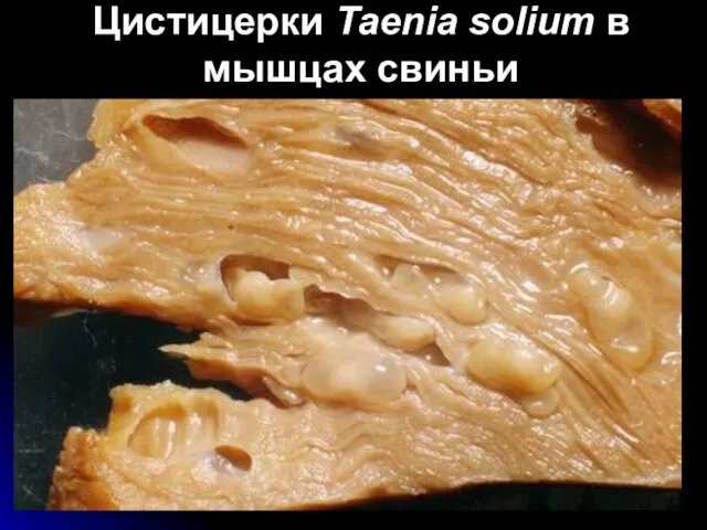 Цистицерки Taenia solium в мышцах свиньи