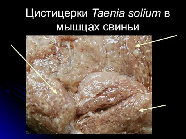 Цистицерки Taenia solium в мышцах свиньи