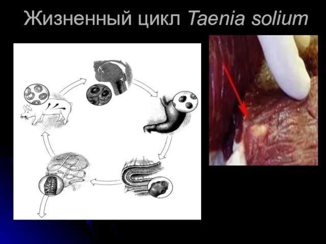 Жизненный цикл Taenia solium