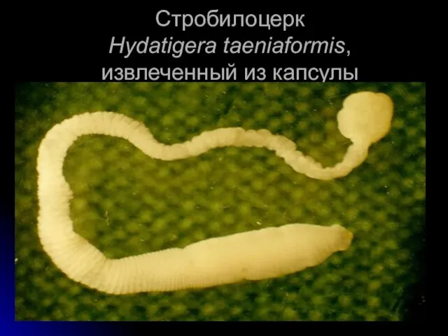 Стробилоцерк Hydatigera taeniaformis, извлеченный из капсулы