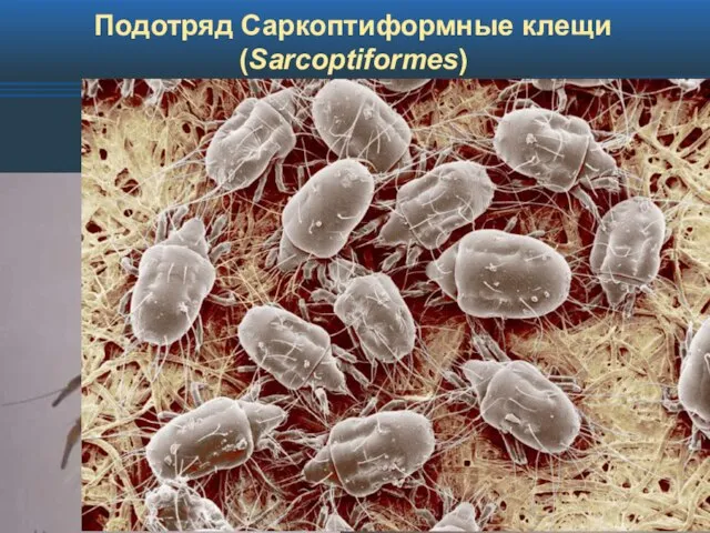 Подотряд Саркоптиформные клещи (Sarcoptiformes)