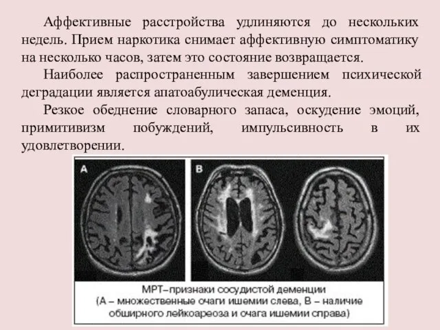 Аффективные расстройства удлиняются до нескольких недель. Прием наркотика снимает аффективную симптоматику