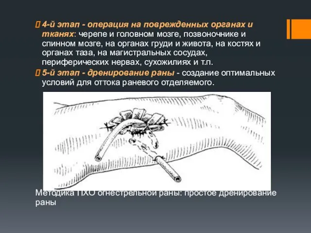 4-й этап - операция на поврежденных органах и тканях: черепе и