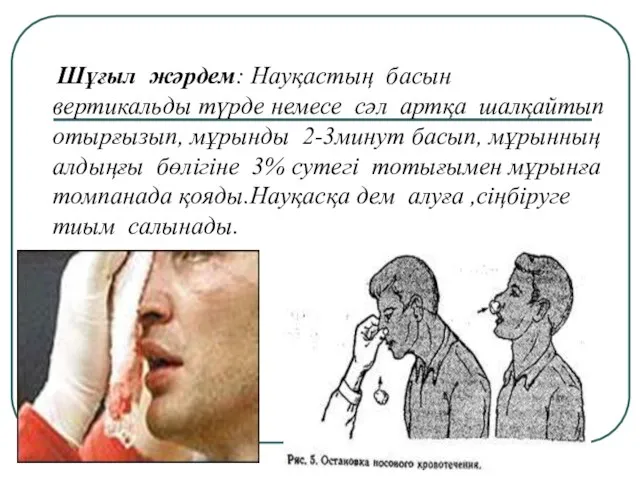 Шұғыл жәрдем: Науқастың басын вертикальды түрде немесе сәл артқа шалқайтып отырғызып,