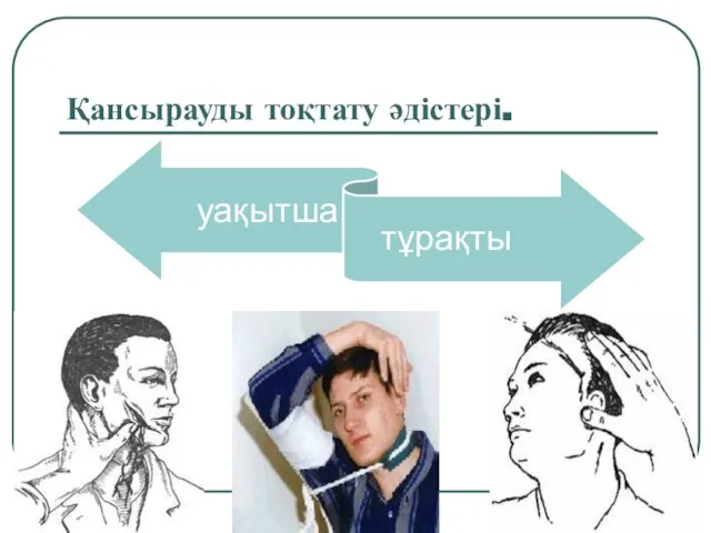 Қансырауды тоқтату әдістері.