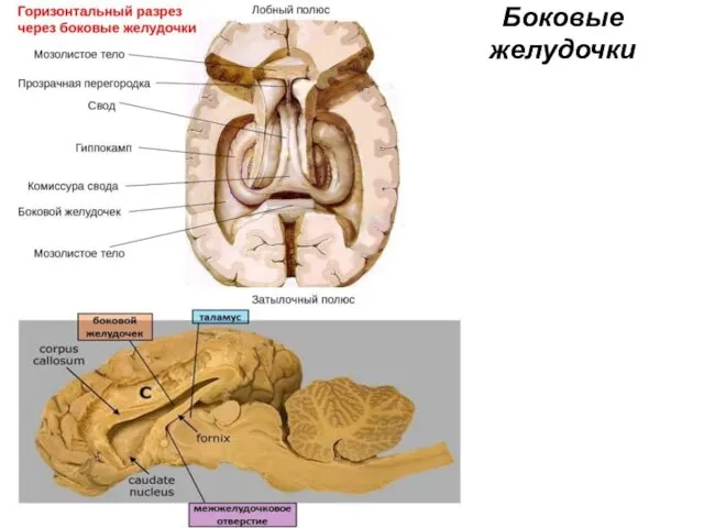 Боковые желудочки