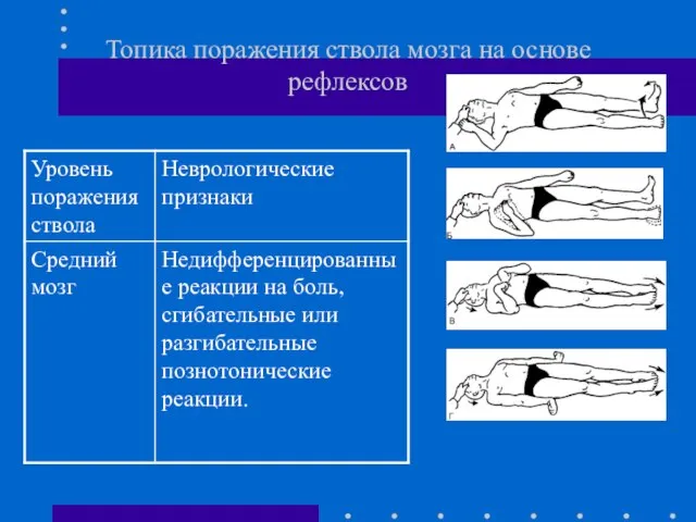 Топика поражения ствола мозга на основе рефлексов