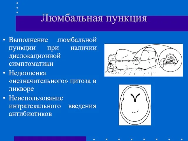 Люмбальная пункция Выполнение люмбальной пункции при наличии дислокационной симптоматики Недооценка «незначительного»