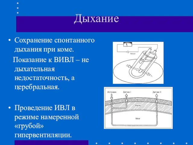 Дыхание Сохранение спонтанного дыхания при коме. Показание к ВИВЛ – не