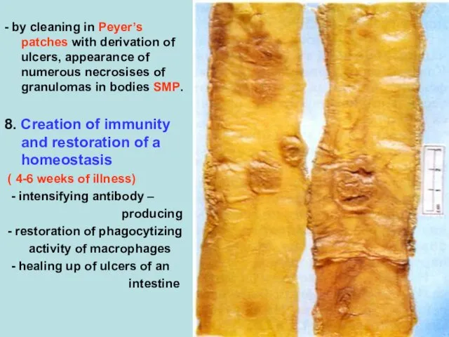 - by cleaning in Peyer’s patches with derivation of ulcers, appearance