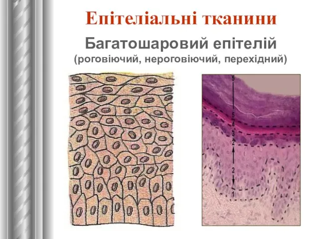 Багатошаровий епітелій (роговіючий, нероговіючий, перехідний) Епітеліальні тканини