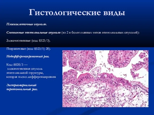 Гистологические виды Плоскоклеточные опухоли. Смешанные эпителиальные опухоли (из 2 и более