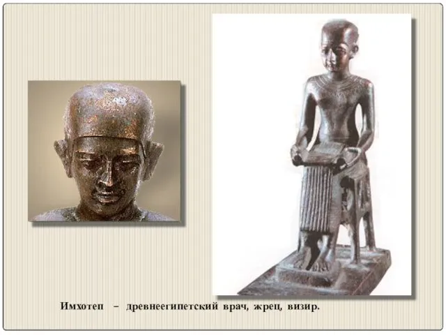 Имхотеп – древнеегипетский врач, жрец, визир.