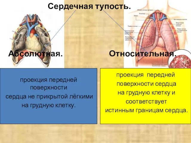 Сердечная тупость. Абсолютная. Относительная. проекция передней поверхности сердца не прикрытой лёгкими