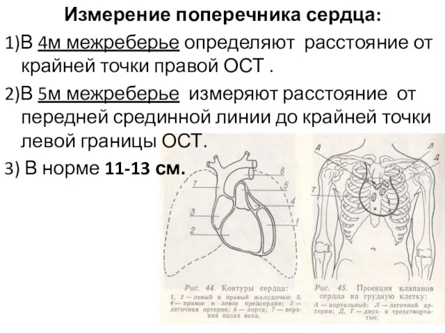 Измерение поперечника сердца: 1)В 4м межреберье определяют расстояние от крайней точки