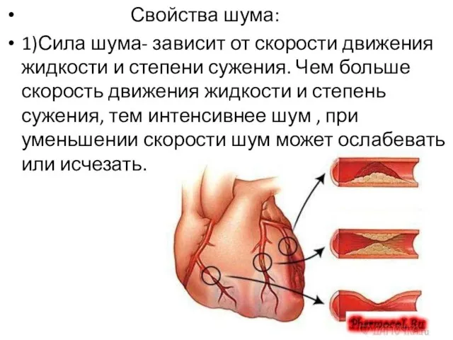 Свойства шума: 1)Сила шума- зависит от скорости движения жидкости и степени