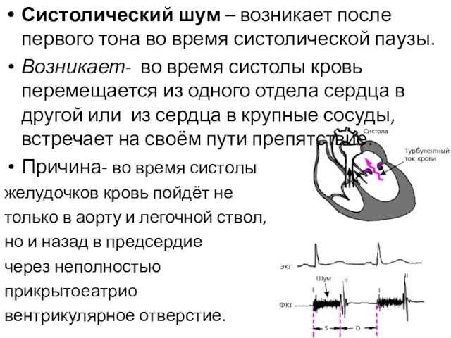 Систолический шум – возникает после первого тона во время систолической паузы.