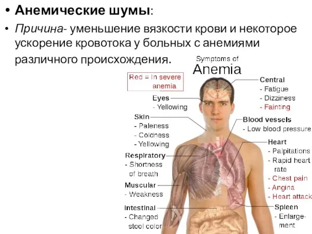 Анемические шумы: Причина- уменьшение вязкости крови и некоторое ускорение кровотока у больных с анемиями различного происхождения.