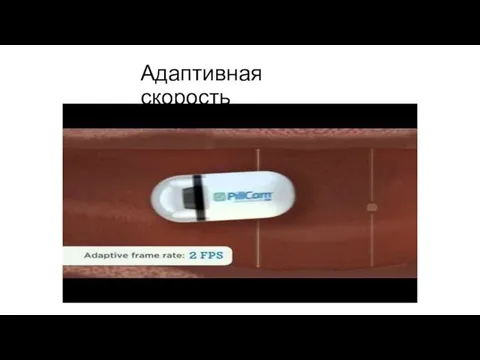 Адаптивная скорость