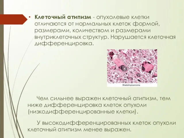 Клеточный атипизм - опухолевые клетки отличаются от нормальных клеток формой, размерами,