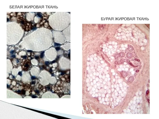 БУРАЯ ЖИРОВАЯ ТКАНЬ БЕЛАЯ ЖИРОВАЯ ТКАНЬ