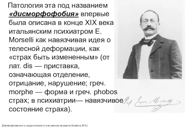 Патология эта под названием «дисморфофобия» впервые была описана в конце XIX