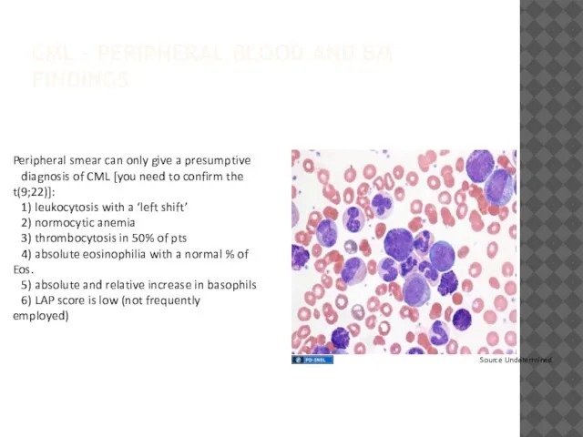 CML – PERIPHERAL BLOOD AND BM FINDINGS Peripheral smear can only