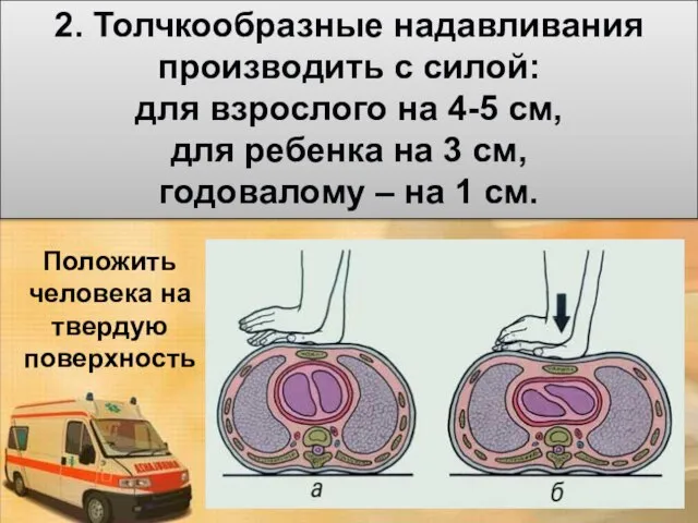 2. Толчкообразные надавливания производить с силой: для взрослого на 4-5 см,