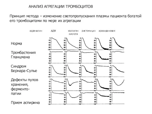 адреналин АДФ коллаген ристомицин арахидоновая кислота Норма Тромбастения Гланцмана Синдром Бернара-Сулье