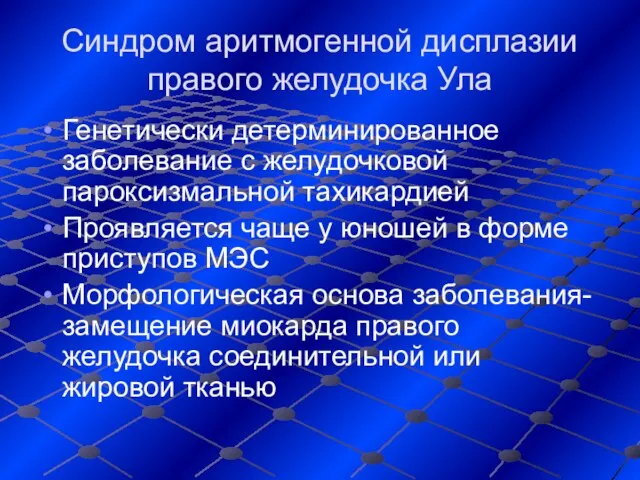 Синдром аритмогенной дисплазии правого желудочка Ула Генетически детерминированное заболевание с желудочковой