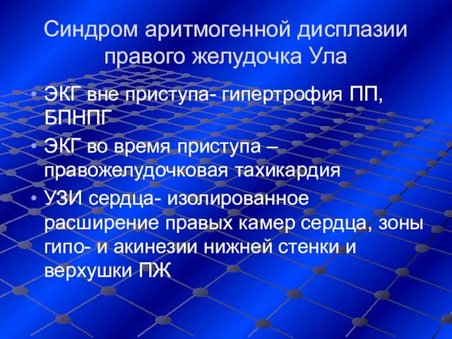 Синдром аритмогенной дисплазии правого желудочка Ула ЭКГ вне приступа- гипертрофия ПП,