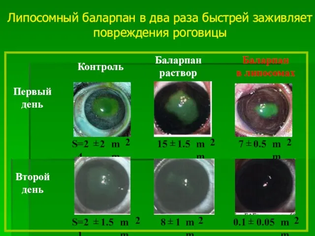 Липосомный баларпан в два раза быстрей заживляет повреждения роговицы