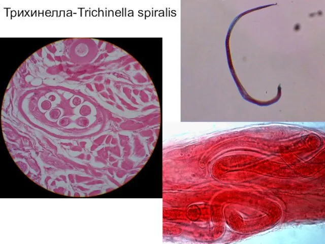Трихинелла-Trichinella spiralis
